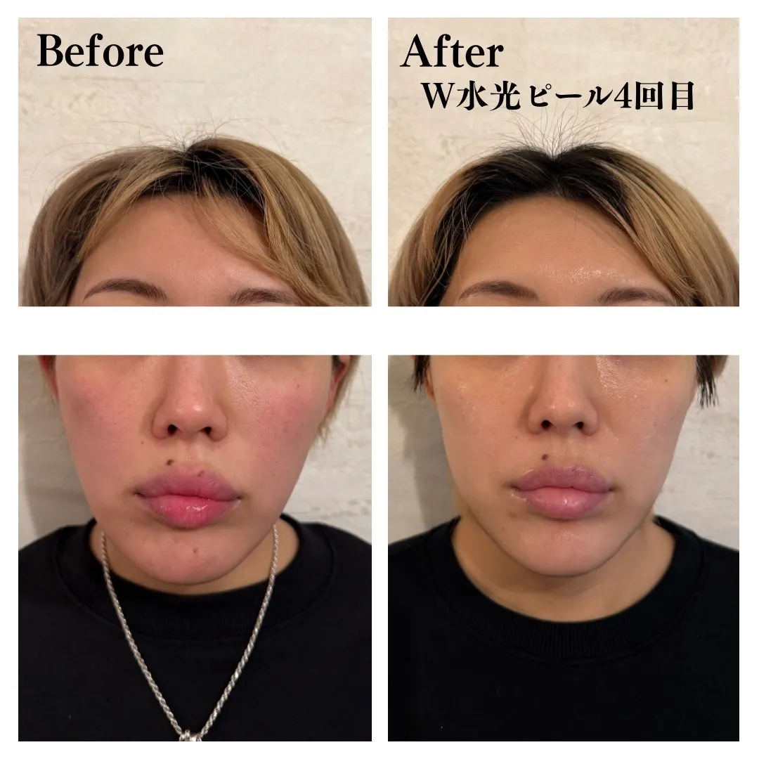 20251028092320.jpg